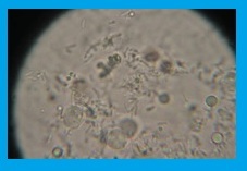 Microscopic evaluation of urine